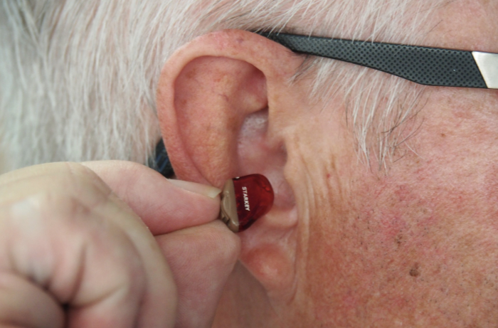 Concealed in Canal (CIC) Hearing Aid