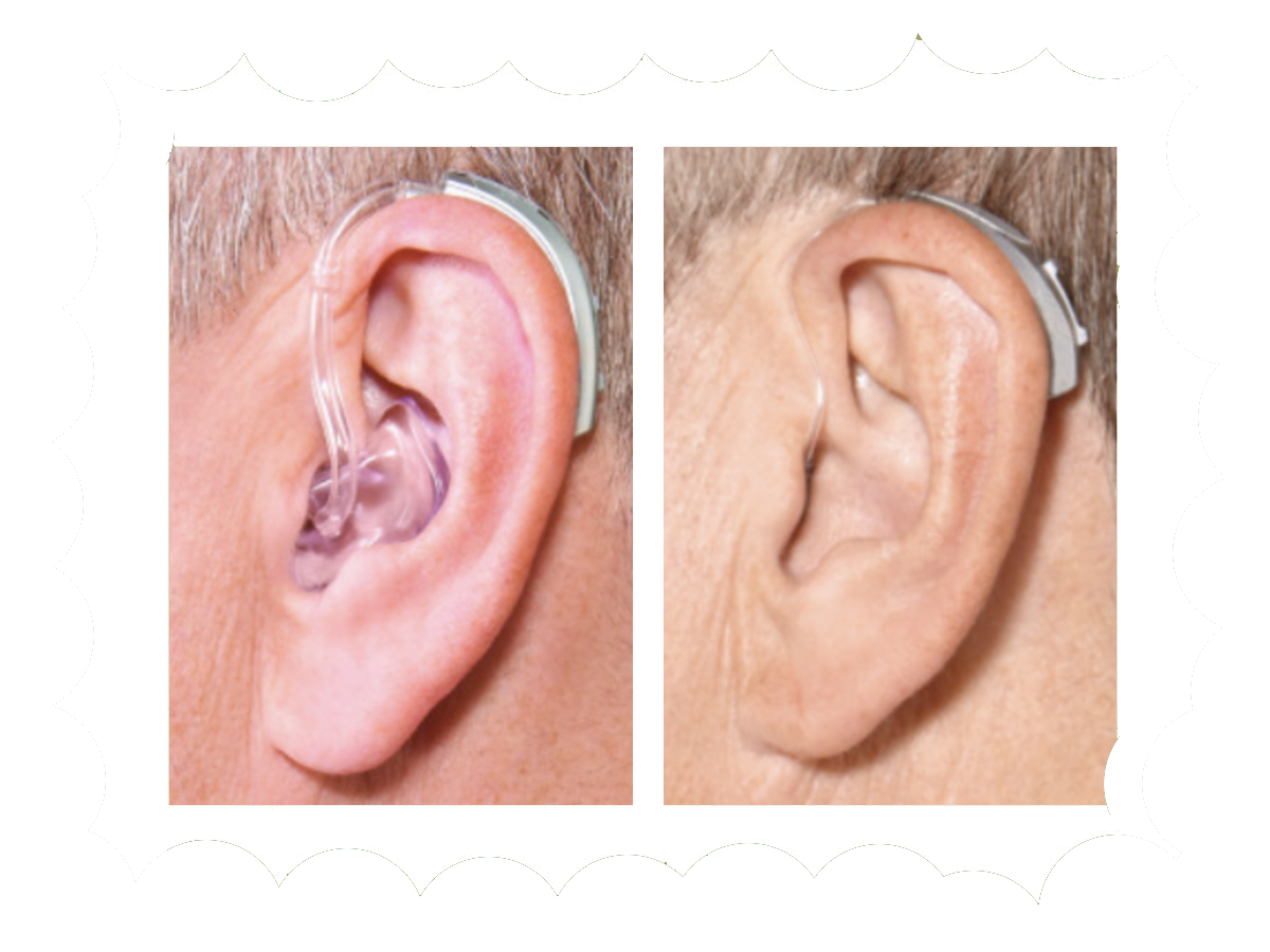 A tale of two hearing aids